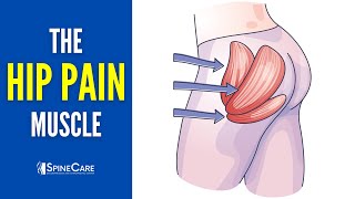 The Hip Pain Muscle How to Release It for INSTANT RELIEF [upl. by Shu]