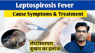 Leptospira Infection Cause Symptoms and Treatment in hindi  Leptospirosis  Fever [upl. by Nomelihp]