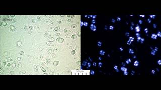 Chemical Gelatinization of High Amylose Barley Starch [upl. by Aiza]