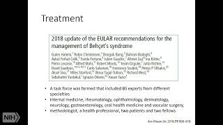 Diagnosis and Management of Behçet’s Disease [upl. by Yeruoc]