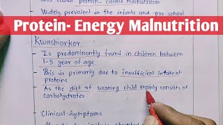 Protein  Energy Malnutrition  Kwashiorkor  Marasmus  Biochemistry [upl. by Onaivlis407]