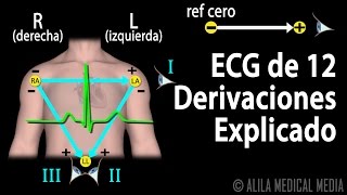 ECG de 12 Derivaciones Explicado Animación Alila Medical Media Español [upl. by Lamee]