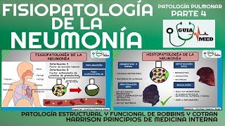 NEUMONÍA ADQUIRIDA EN LA COMUNIDAD FISIOPATOLOGÍA PARTE 1 GuiaMed [upl. by Douglass720]