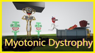 Myotonic Dystrophy Mnemonic for the USMLE [upl. by Livesay]