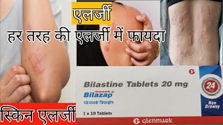 How to use Bilastine 20 mg  Dose Side effect  Benefits in hindi  Bilastine [upl. by Ahsiuqet]