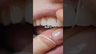 Get sparkling white teeth shorts ytshorts youtubeshorts dentist yourdentist [upl. by Lewak]