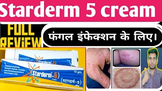 Starderm 5 cream uses in hindi  anti fungel cream  dermi 5 cream uses in hindi [upl. by Cirilla891]