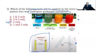 INICET Nov 2021 Biochemistry Recall [upl. by Nadaba645]