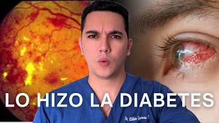 Creyó que perdía la vista por la edad pero era la diabetes  Dr William Guerrero [upl. by Llerdnam]