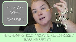 SKINCARE WEEK DAY 7 The Ordinary 100 Organic ColdPressed Rose Hip Seed Oil Review [upl. by Cayla]