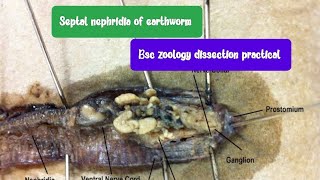 Septal nephridia of earthworm dissection BSc zoology 5 semester [upl. by Trebreh818]