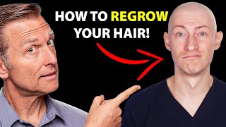 How to Regrow Your Hair UPDATED VITAL INFO  Hair Surgeon Reacts [upl. by Iredale]