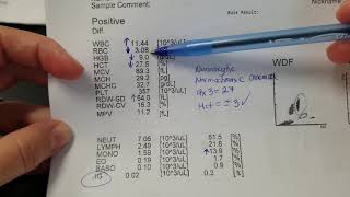 Hematology How to interpret automated Complete Blood Count CBC results [upl. by Ynnavoj766]