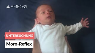 MoroReflex  Frühkindliche Reflexe  AMBOSS Video [upl. by Dinin]