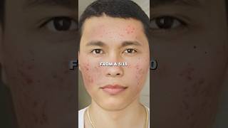 Zuniga on Natural Face Mask Glow Up in 7 Days [upl. by Cliff]