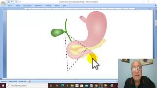 Pancreatic Disorders in Arabic 6  Zollinger Ellison Syndrome  by Dr Wahdan [upl. by Nosyrb337]