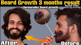 Dermaroller for beard growth  Derma roller beard before and after  Beard Products  review [upl. by Sokcin]