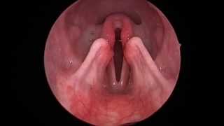 Dog Lar Par Laryngeal paralysis observed in sedated canine oral exam [upl. by Wivina]