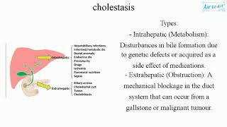 cholestasis [upl. by Aniroc]