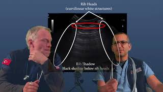 Pleural and lung ultrasound part 1 How to find the pleural line and identify a glide sign [upl. by Ynahirb]