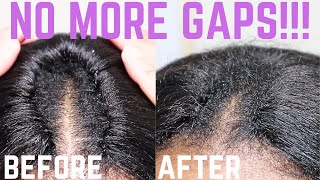 HOW TO FIX CROCHET BRAID SPACINGGAPS Invisible Part  crochetbraids [upl. by Hort]