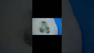 Foco no MV2 MV2 endodontia tratamentodecanal [upl. by Bobbye124]