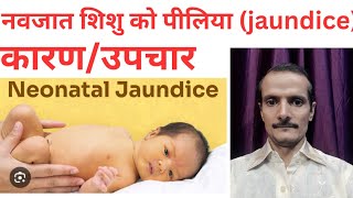 Neonatal jaundice navjat shishu ka jaundice Physiological jaundice [upl. by Juanne938]