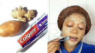 DID YOU KNOW TOOTHPASTE AND POTATO CAN CHANGE YOUR FACE OVERNIGHT REMOVE PIMPLES DARK SPOTS [upl. by Akselav]