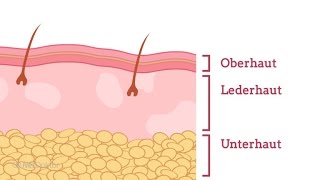 Wie entsteht Neurodermitis  NetDoktorde [upl. by Asiel]