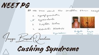 Cushing Syndrome  Image based questions  for NEET PG [upl. by Assirrec]