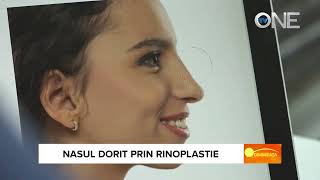 Rinoplastie  riscuri si asteptari realiste [upl. by Fortna]