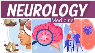 Neurology Medicine 10  Migraine [upl. by Sauder]