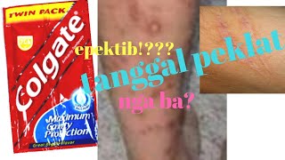 EFFECTIVE PANTANGGAL PEKLAT NA MATAGAL NA TANGGAL MAITIM NA PEKLAT Colgate Scars Remover [upl. by Nwahsyd]