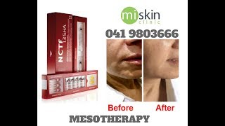 Filorga NCTF Mesotherapy [upl. by Ennayrb608]