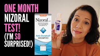 HAIR LOSS SUFFERER REVIEWS NIZORAL SHAMPOO One Month Review On 2 Ketoconazole IM VERY SURPRISED [upl. by Beaufort]