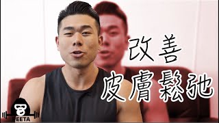 皮膚鬆弛預防以及改善方式｜減脂後皮膚緊繃繃 [upl. by Eivod]