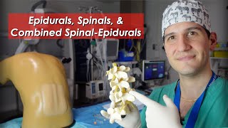 Epidural spinal and combined spinalepidural overview [upl. by Verna172]