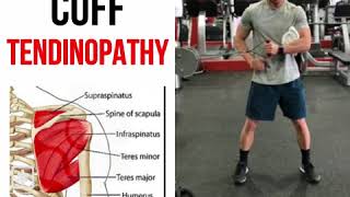 Rotator Cuff Tendinopathy [upl. by Anileda]