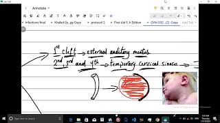 Lecture 1  Endocrine System  Thyroglossal Duct and Pharyngeal Cleft Cysts  USMLE STEP 1  Arabic [upl. by Ashraf]