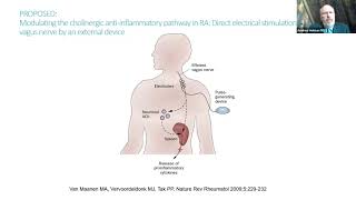 UW Rheumatology Grand Rounds  Andrew Holman 11122024 [upl. by Atsed]