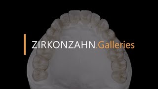 Complete restoration made with Prettau® 4 Anterior® zirconia  ZirkonzahnGalleries [upl. by Lohrman]