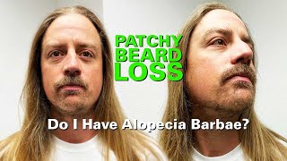 Patchy Beard Loss Do I Have Alopecia Barbae [upl. by Emilia77]