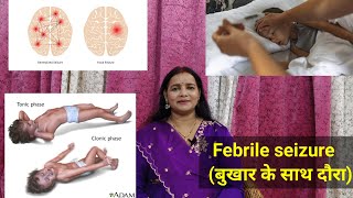 Febrile ConvulsionSeizure in childrenFever with convulsions बुखार के साथ दौरातड़का drniteshraj [upl. by Amer133]