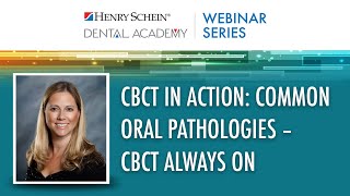 CBCT in Action Common Oral Pathologies [upl. by Bonn]