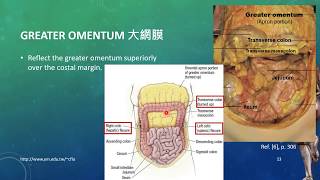 20171019 Lesson10Human Dissection  Peritoneum amp Peritoneal Cavity [upl. by Udella]