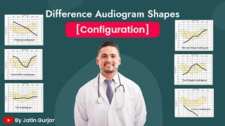 Different Audiogram Shapes Configuration [upl. by Alesram]