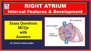 Right atrium anatomy  External and internal features of right atrium Simplified [upl. by Wendel919]