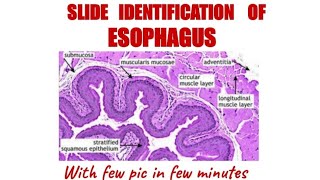 ESOPHAGUS HISTOLOGYIdentification points [upl. by Nehgam860]