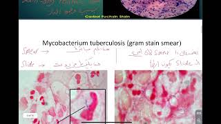 Microbiology practical Mycobacterium [upl. by Nacul496]