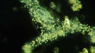 Amazing Amoeba in high definition [upl. by Cusick]